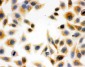 Anti-DCI Antibody